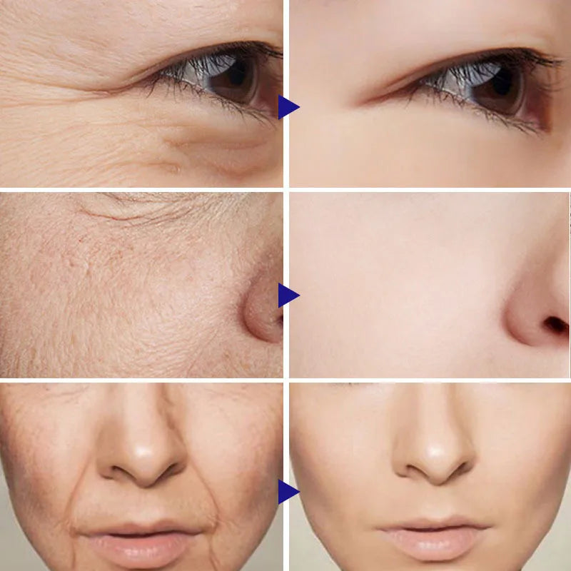 Retinol Anti Aging Face Cream for Wrinkles