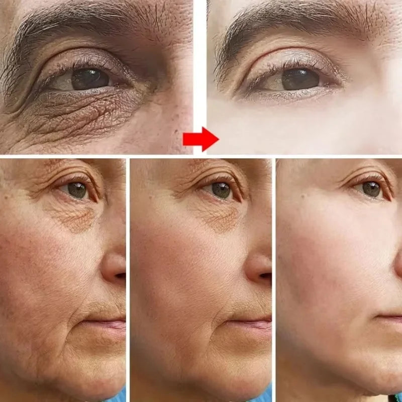Retinol Anti Aging Face Cream for Wrinkles